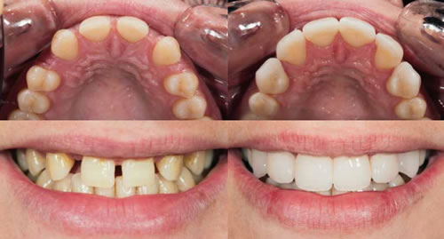 Clínica Dental Rovaletti Fuengirola Mijas Estética Dental