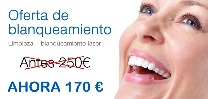 Oferta blanqueamiento Ofertas de blanqueamiento dental en Fuengirola